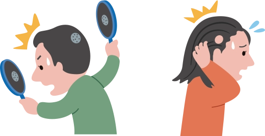 円形脱毛症の概要